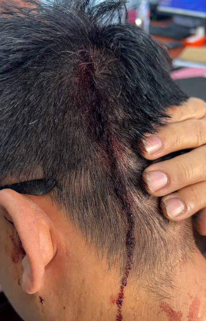 Điều tra vụ người đàn ông bị hàng xóm tấn công gây thương tích - Ảnh 1.