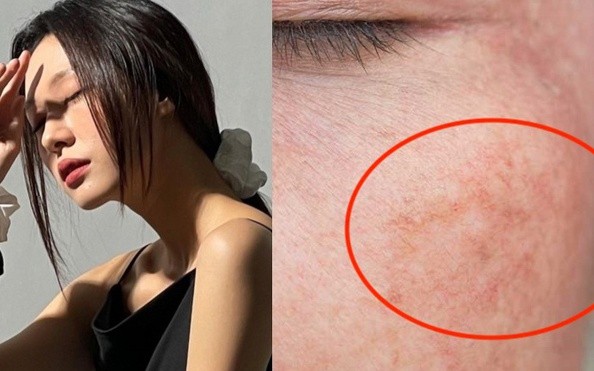 4 serum mờ n&aacute;m, t&agrave;n nhang ai cũng bất ngờ v&igrave; hiệu quả với cả ch&acirc;n s&acirc;u - Ảnh 1.