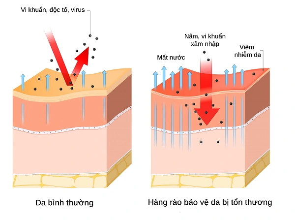 Ảnh hưởng của thời tiết đến h&agrave;ng r&agrave;o bảo vệ da- Ảnh 2.
