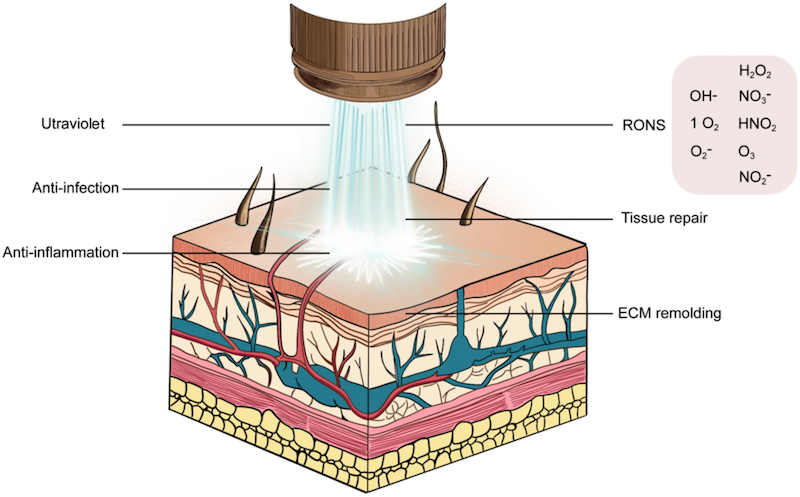 Cold Plasma có gây đau hay châm chích khi ứng dụng trong lâm sàng?- Ảnh 3.