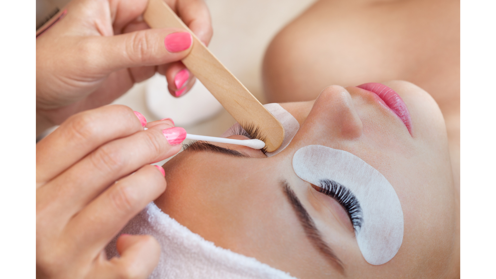 Bệnh viện Da Liễu cảnh b&aacute;o tai biến thẩm mỹ gia tăng từ dịch vụ l&agrave;m đẹp, gi&aacute; rẻ- Ảnh 1.