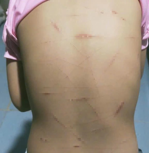 Vụ học sinh lớp 5 ở C&agrave; Mau nghi bị bạo h&agrave;nh: C&ocirc;ng an b&aacute;o c&aacute;o vụ việc ban đầu như thế n&agrave;o? - Ảnh 1.