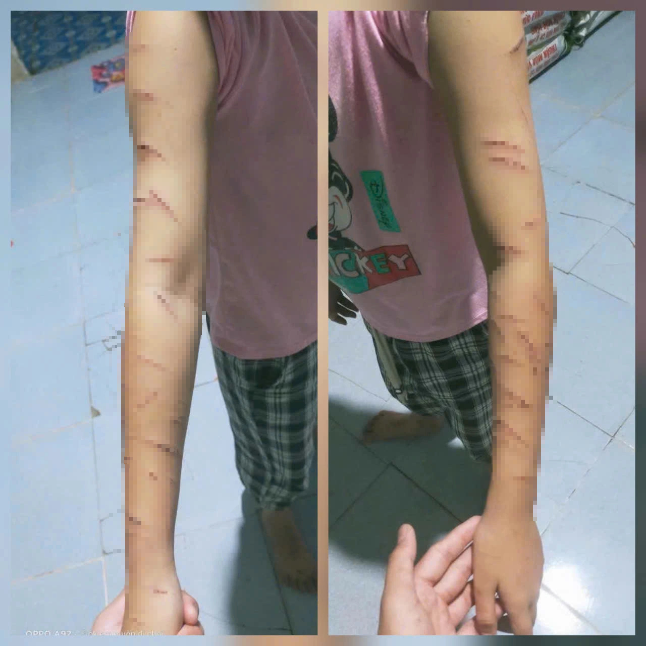 Vụ học sinh lớp 5 ở Cà Mau nghi bị bạo hành: Công an báo cáo vụ việc ban đầu như thế nào? - Ảnh 2.