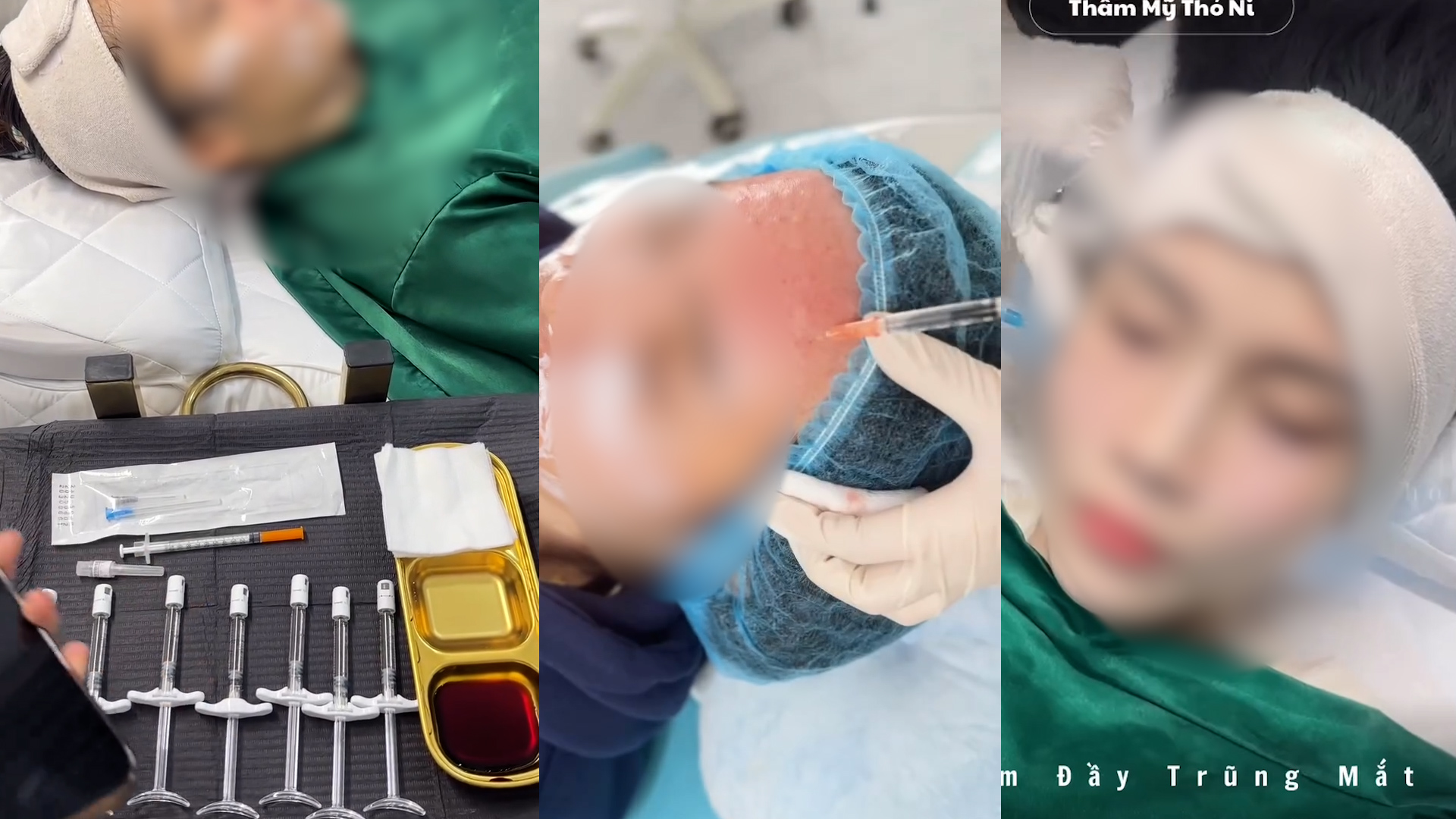 Thẩm mỹ chui bủa v&acirc;y: Cận cảnh quy tr&igrave;nh l&agrave;m đẹp kh&ocirc;ng ph&eacute;p tại Đ&agrave; Nẵng  - Ảnh 1.