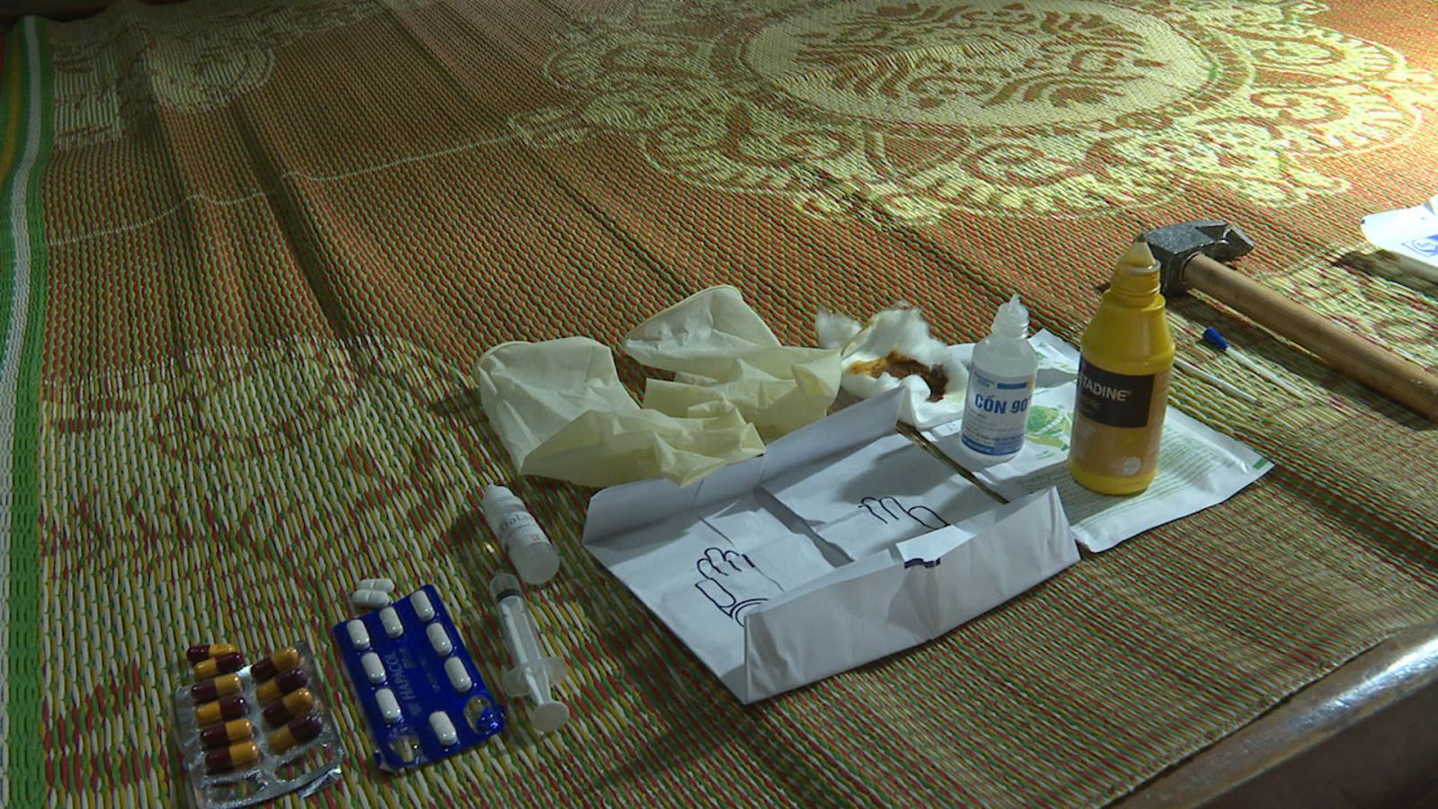 Công an thực nghiệm điều tra vụ tự đập vỡ xương để trục lợi bảo hiểm - Ảnh 2.