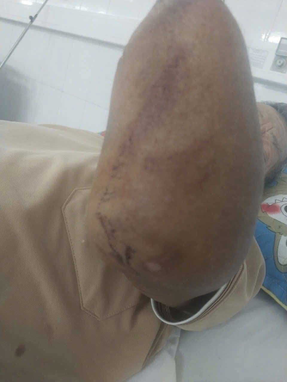 Con trai kể khoảnh khắc cụ &ocirc;ng cụt 2 tay kẹp rắn hổ mang đem về nh&agrave;- Ảnh 2.