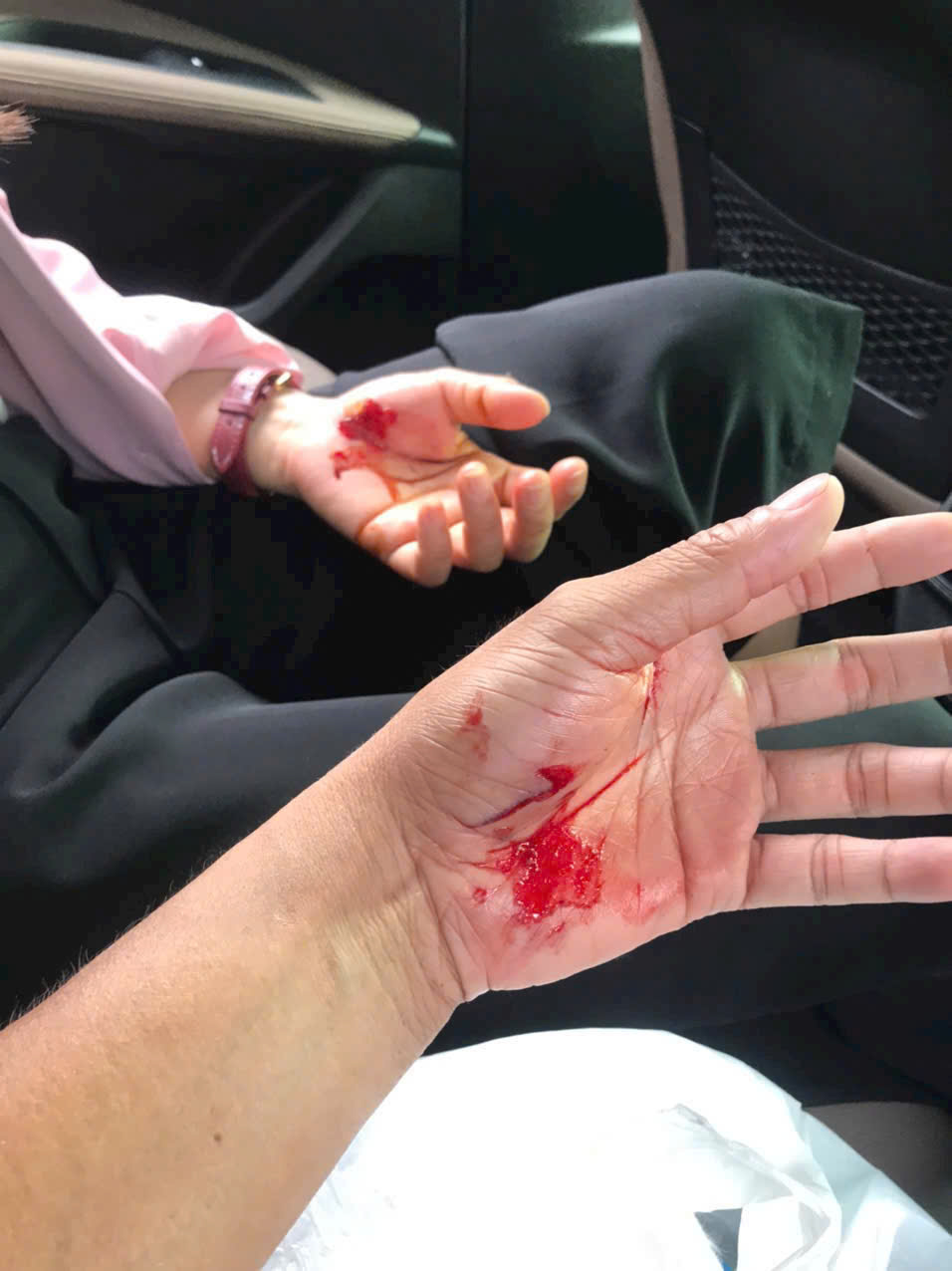 Nỗi ám ảnh mang tên chó thả rông tại một khu dân cư ở Nhà Bè - Ảnh 4.