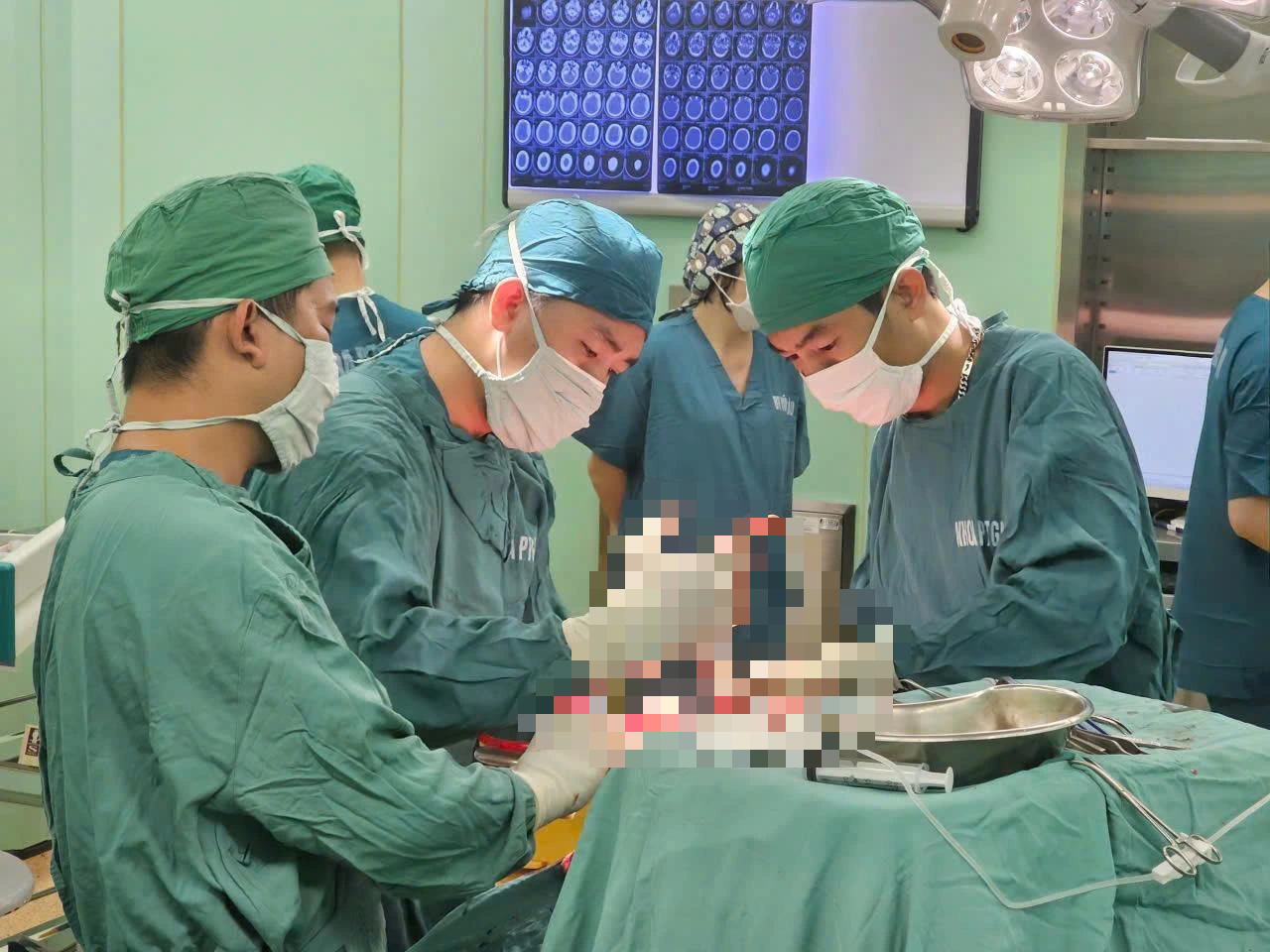 Phẫu thuật cứu sống bệnh nhân chấn thương sọ não nặng tại Vũng Tàu - Ảnh 1. Phẫu thuật cứu sống bệnh nhân chấn thương sọ não nặng tại Vũng Tàu - Ảnh 1.