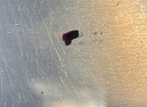 Hy hữu: Mảnh kim loại bắn xuy&ecirc;n tinh ho&agrave;n nam thanh ni&ecirc;n đang l&agrave;m việc - Ảnh 1.