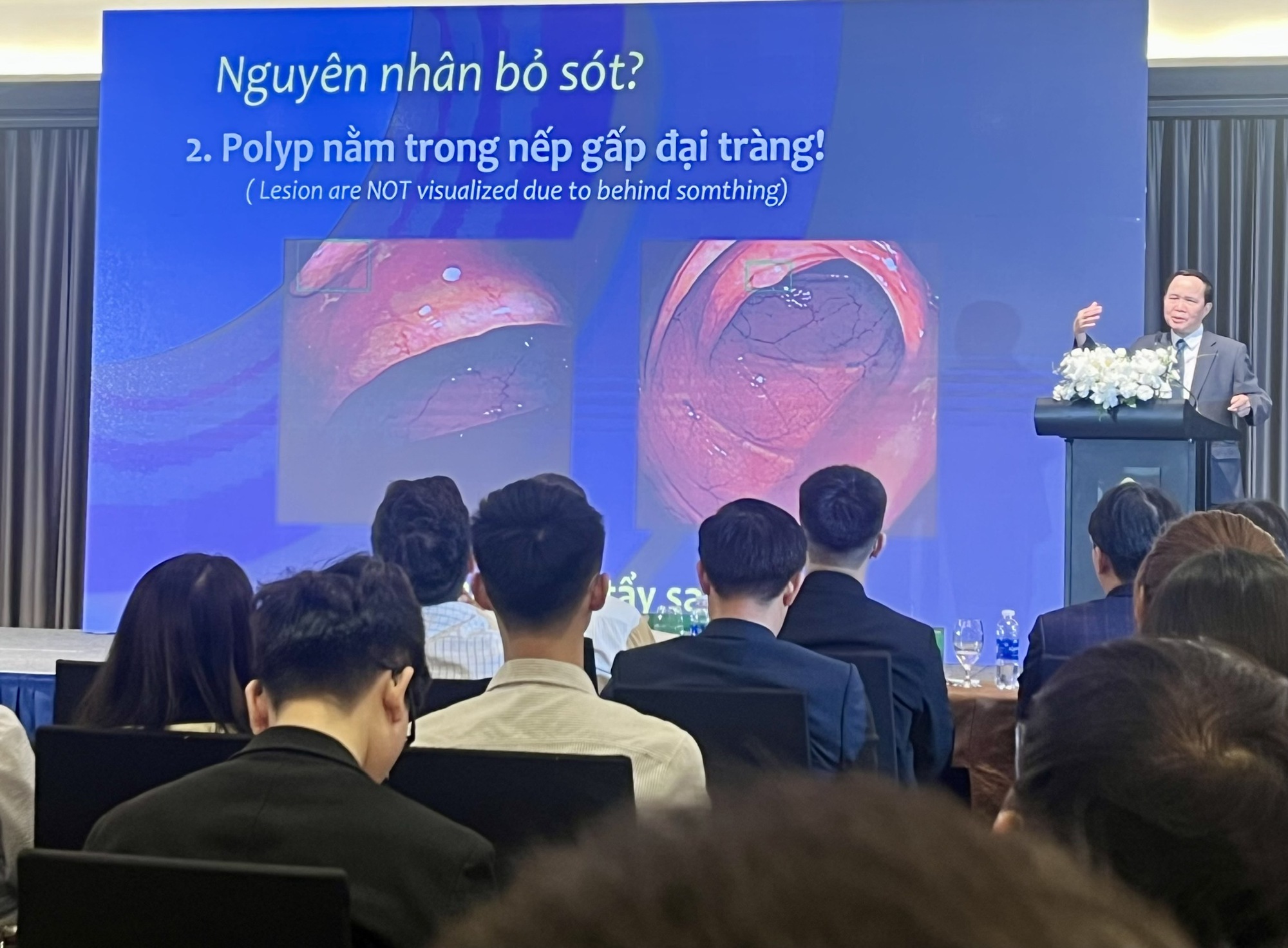 Chuyên gia lưu ý nguy cơ gây ung thư bị bỏ sót trong nội soi tiêu hóa- Ảnh 1. Chuyên gia lưu ý nguy cơ gây ung thư bị bỏ sót trong nội soi tiêu hóa- Ảnh 1.