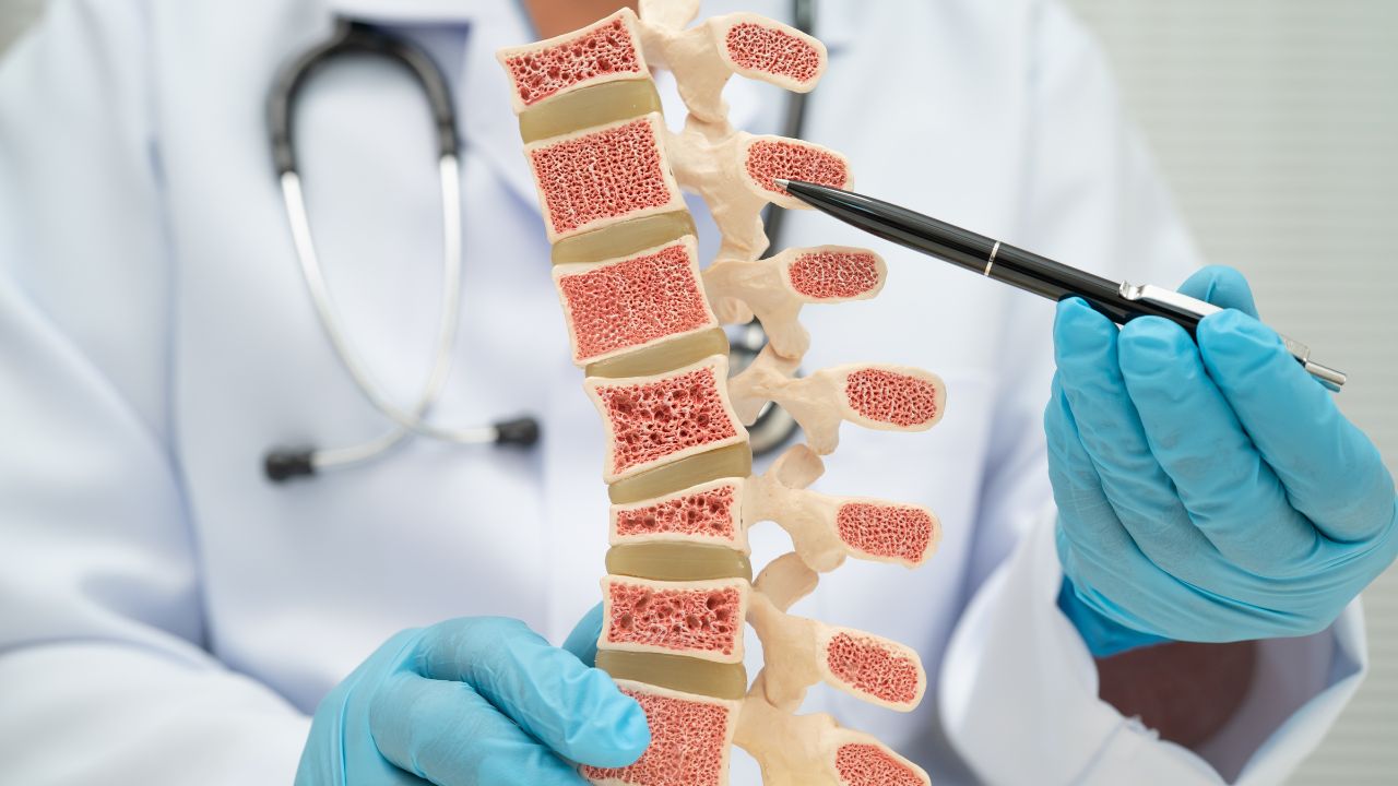 Ăn g&igrave; để kh&ocirc;ng bị lo&atilde;ng xương nhanh?- Ảnh 1.