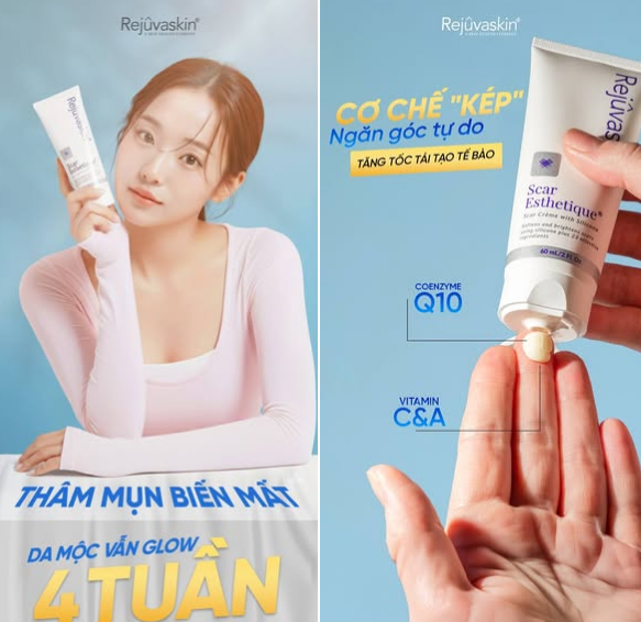 Hướng dẫn sử dụng kem mờ sẹo th&acirc;m Scar Esthetique đ&uacute;ng chuẩn để kh&ocirc;ng ph&iacute; tiền - Ảnh 1.