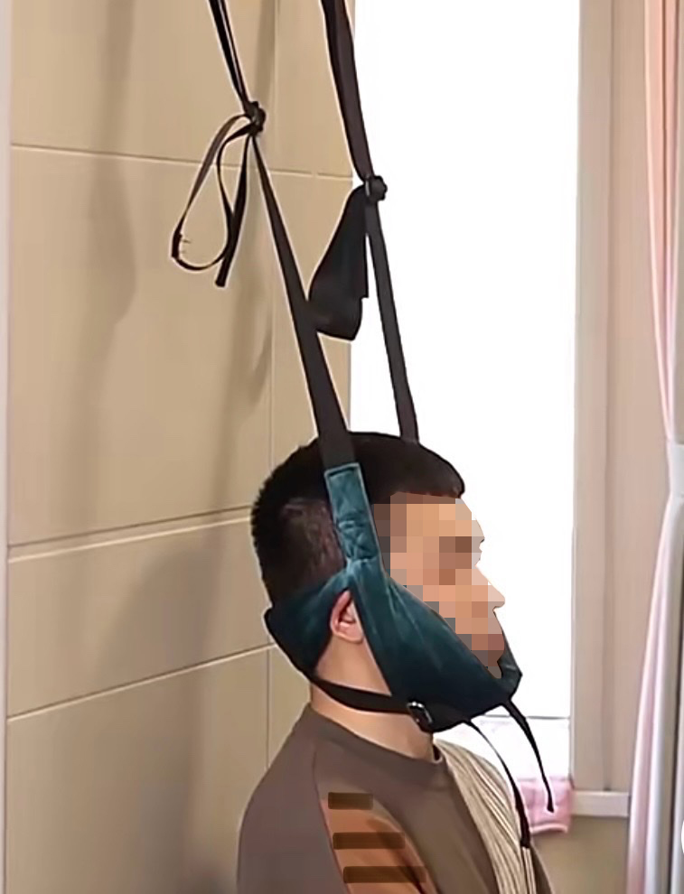 Cảnh báo nguy cơ liệt do tự kéo giãn cột sống cổ 19 Cảnh báo nguy cơ liệt do tự kéo giãn cột sống cổ - Ảnh 1.