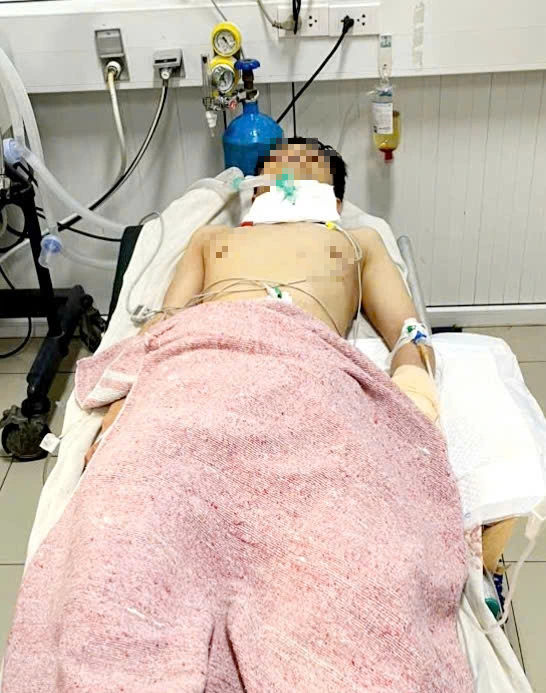 Người t&igrave;nh nghi li&ecirc;n quan vụ nữ sinh tử vong ở ph&ograve;ng trọ cũng thương t&iacute;ch nặng- Ảnh 2.