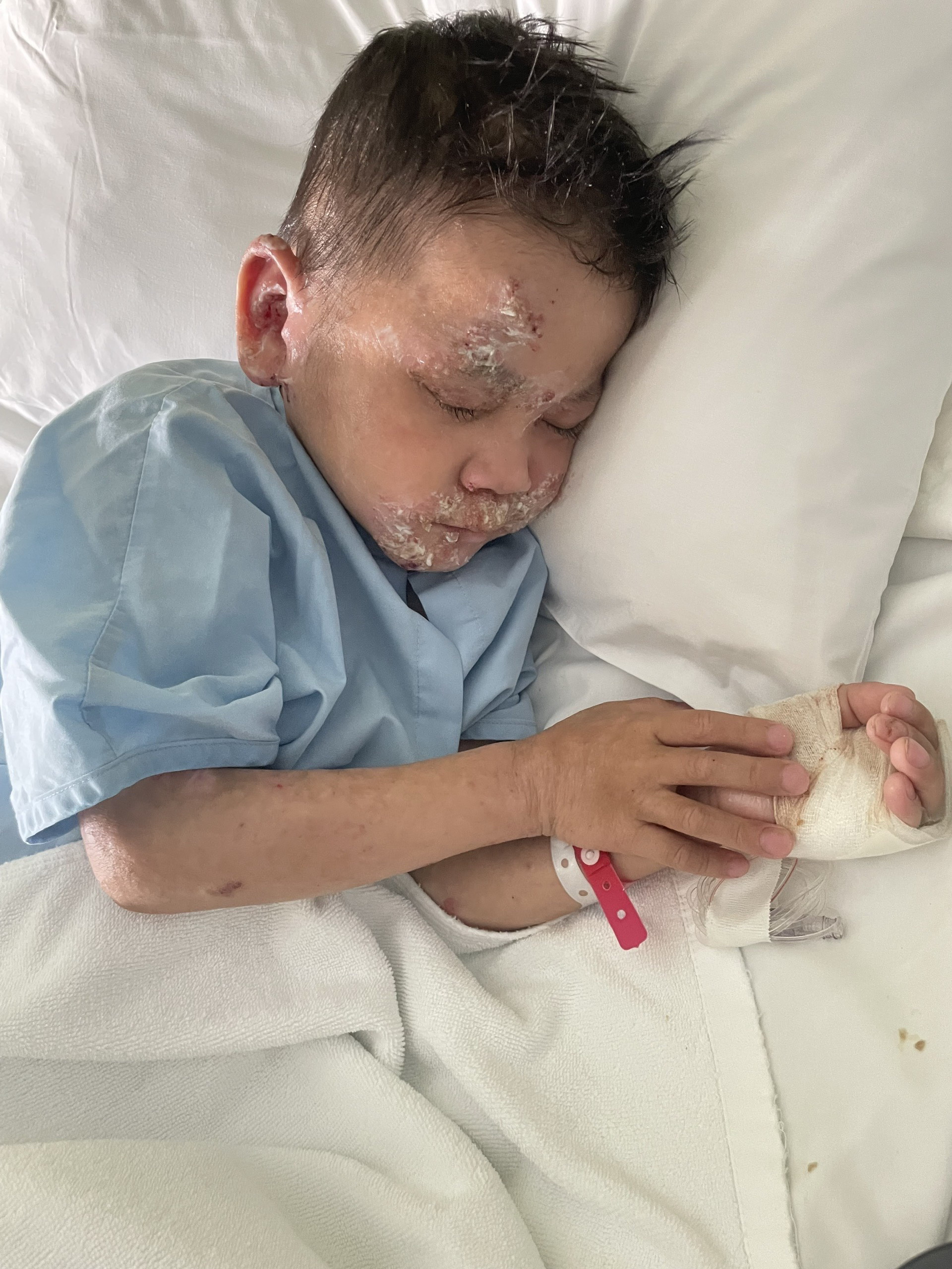 Xin gi&uacute;p ch&aacute;u b&eacute; mắc bệnh hiếm đang gi&agrave;nh giật sự sống- Ảnh 1.