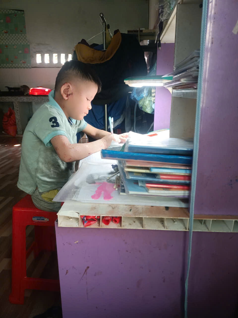 Xin gi&uacute;p ch&aacute;u b&eacute; mắc bệnh hiếm đang gi&agrave;nh giật sự sống- Ảnh 2.