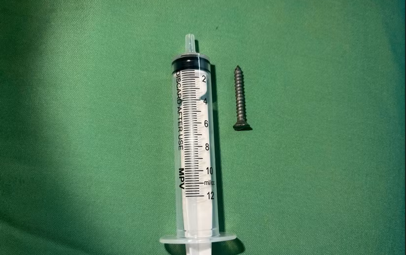 Nuốt đinh, hóc xương, rơi răng giả: Những ca cấp cứu khiến bác sĩ toát mồ hôi - Ảnh 1.