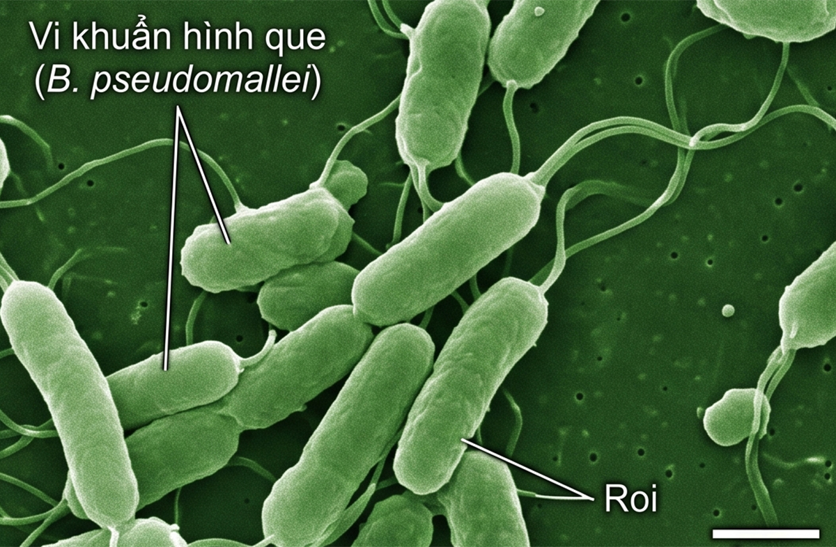 Bệnh 'sốt đất' đang lan rộng ở Thái Lan là bệnh gì? - Ảnh 1.
