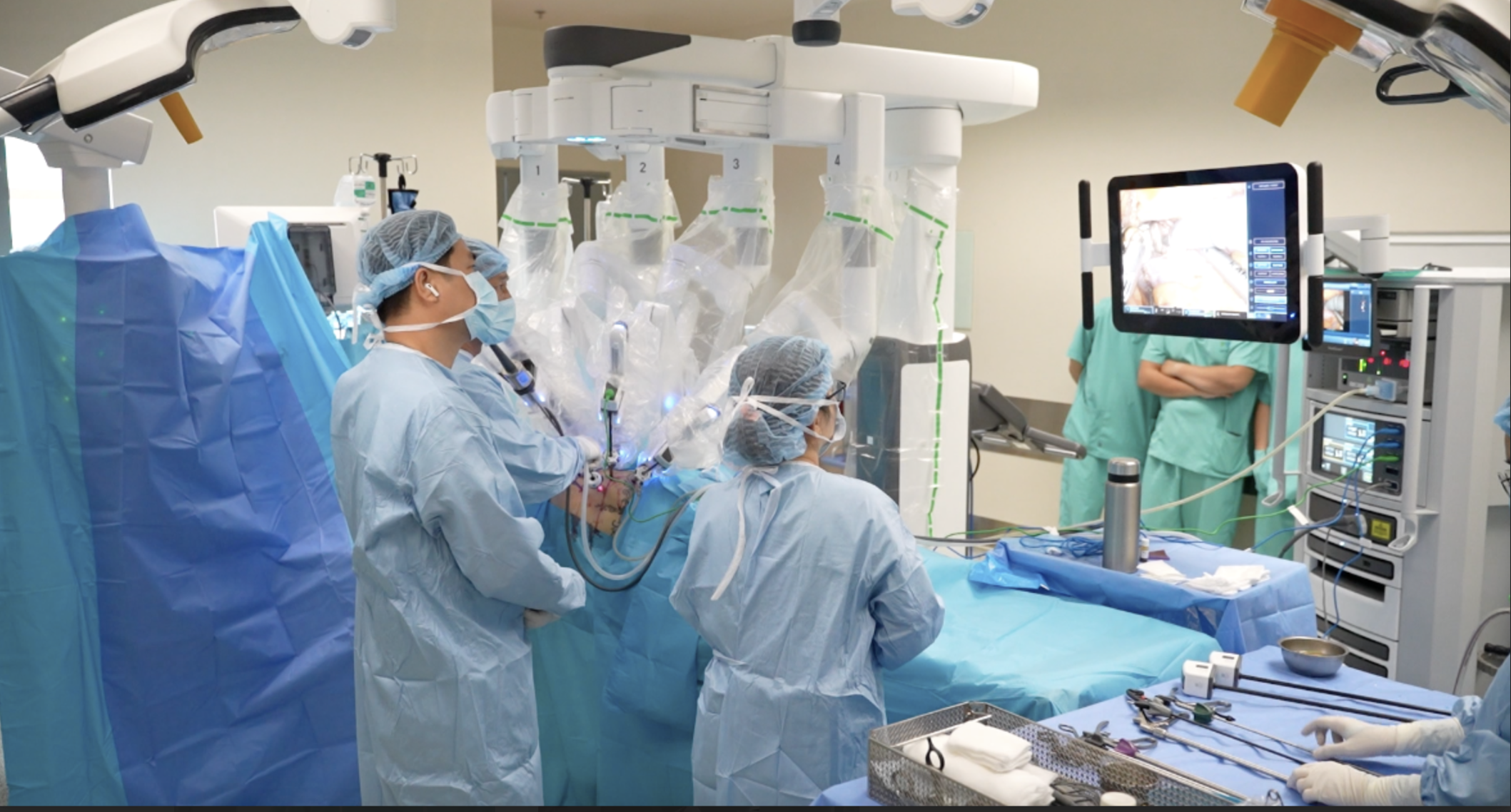 Mổ cắt khối u thận trái bằng robot da Vinci Xi, xuất viện chỉ sau 2 ngày- Ảnh 1.