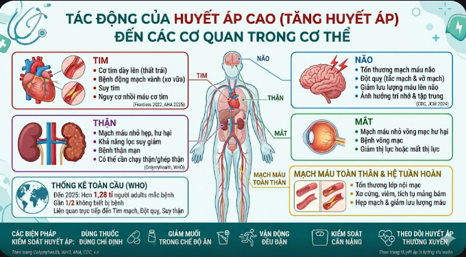Huyết áp cao ảnh hưởng đến cơ thể thế nào? - Ảnh 2.