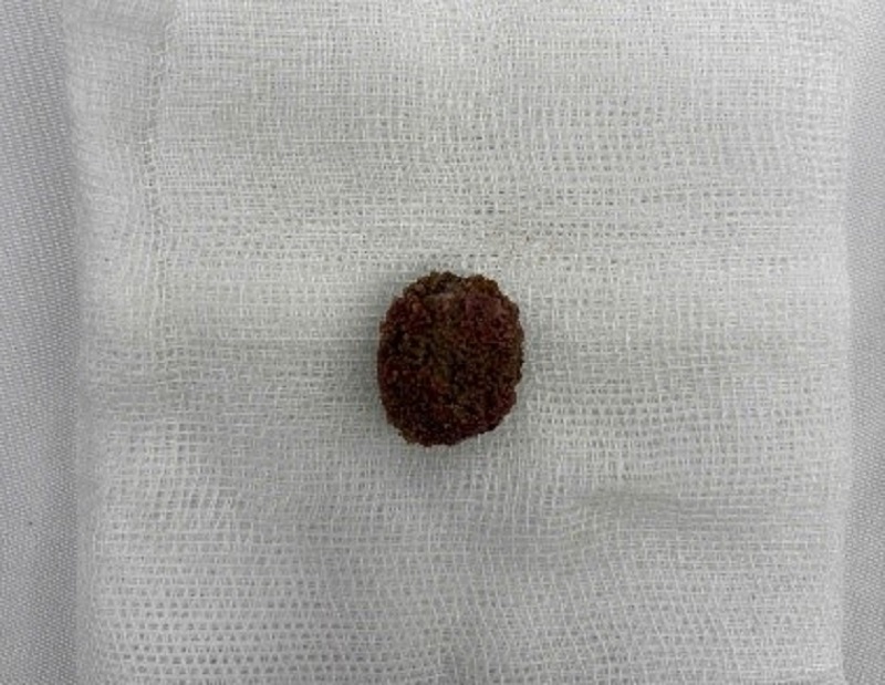 TP.HCM: Tin vào 'thuốc tan sỏi thận' trên mạng, người đàn ông nhập viện nguy kịch - Ảnh 1.