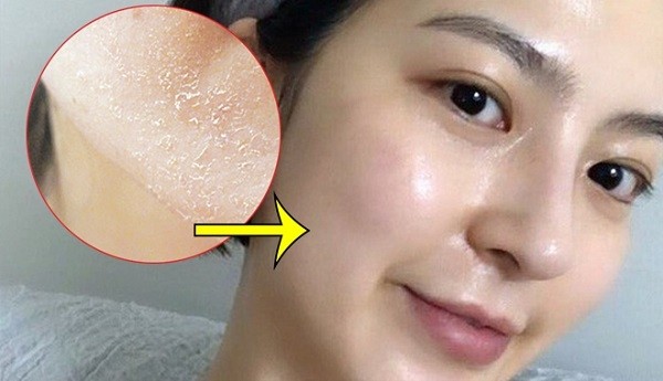 Top 6 sữa rửa mặt cho da kh&ocirc; r&aacute;p, nứt nẻ cũng trở n&ecirc;n mềm mịn - Ảnh 1.
