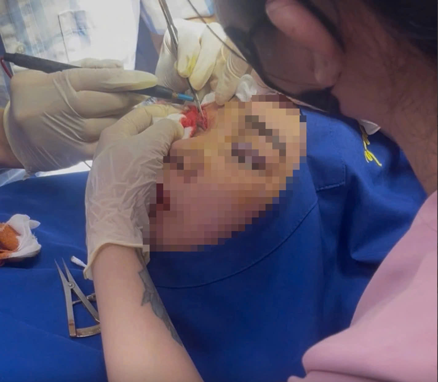 35.000 ca tai biến thẩm mỹ mỗi năm: Cảnh báo mù mắt, hoại tử, tử vong - Ảnh 2. 35.000 ca tai biến thẩm mỹ mỗi năm: Cảnh báo mù mắt, hoại tử, tử vong - Ảnh 2.
