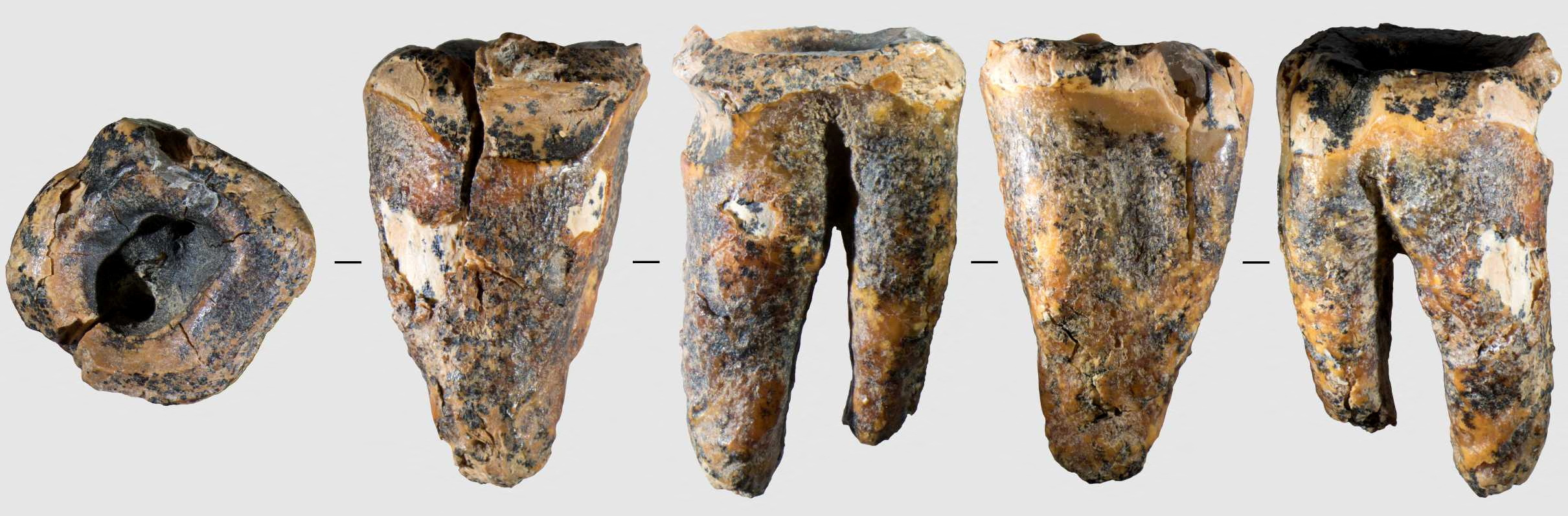 59.000 năm trước, người Neanderthal đã biết trị sâu răng? - Ảnh 2.