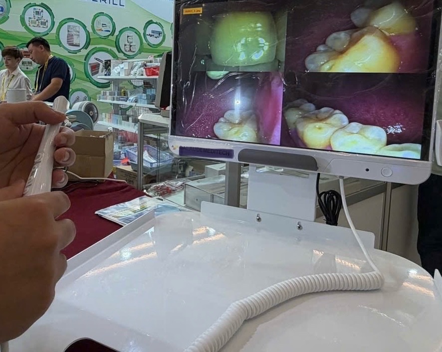 Mỗi người dân sẽ được khám bệnh răng miệng ít nhất 1 lần/năm- Ảnh 1.