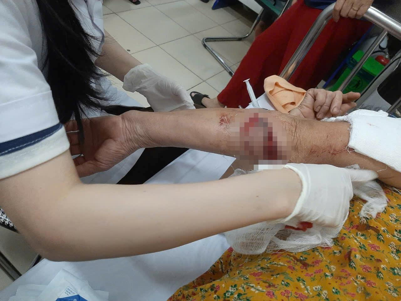Liên tiếp các vụ chó thả rông tấn công người - Ảnh 2.