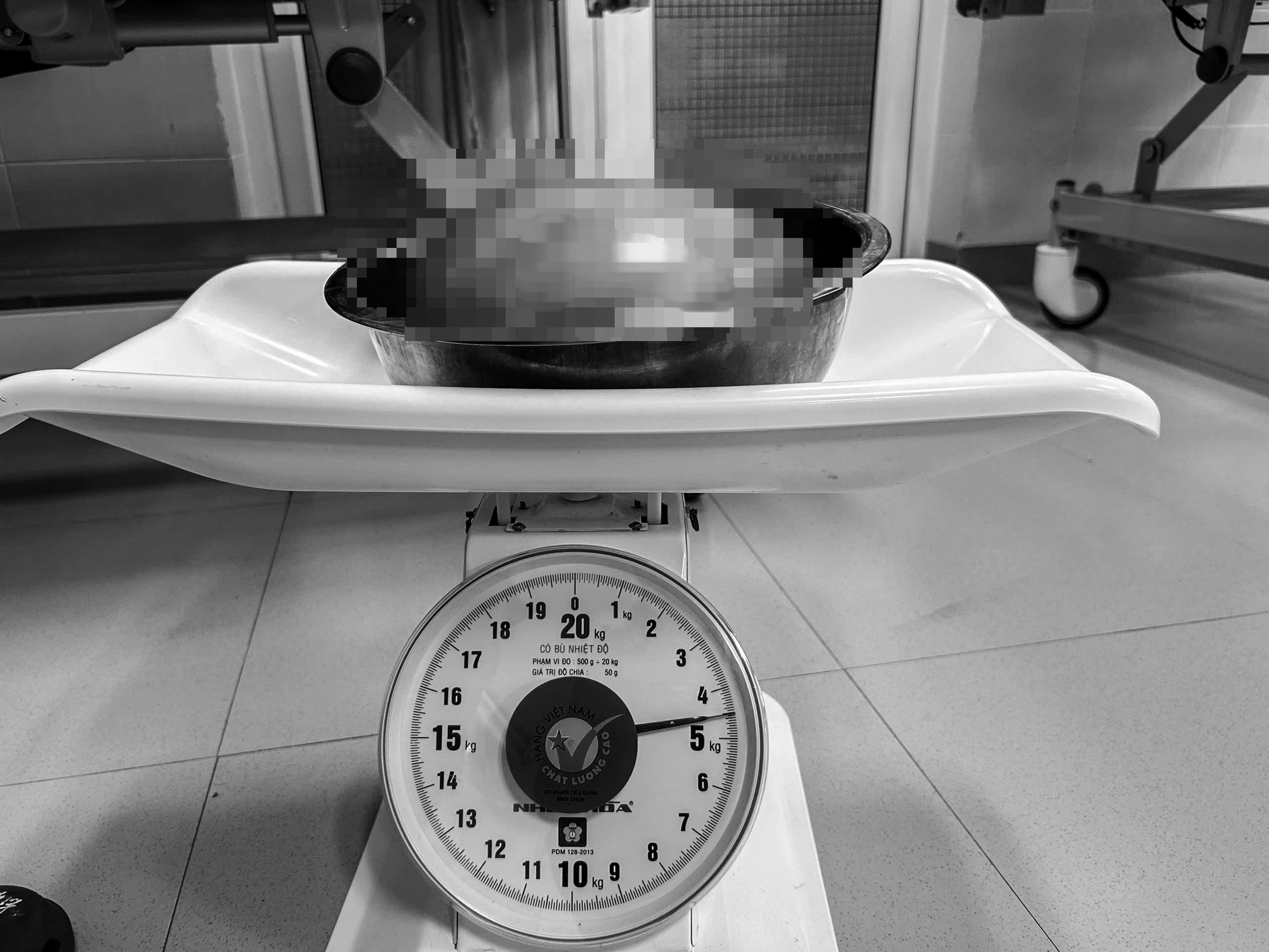 Phẫu thuật thành công khối u xơ tử cung nặng 4,5 kg cho phụ nữ 47 tuổi - Ảnh 2.