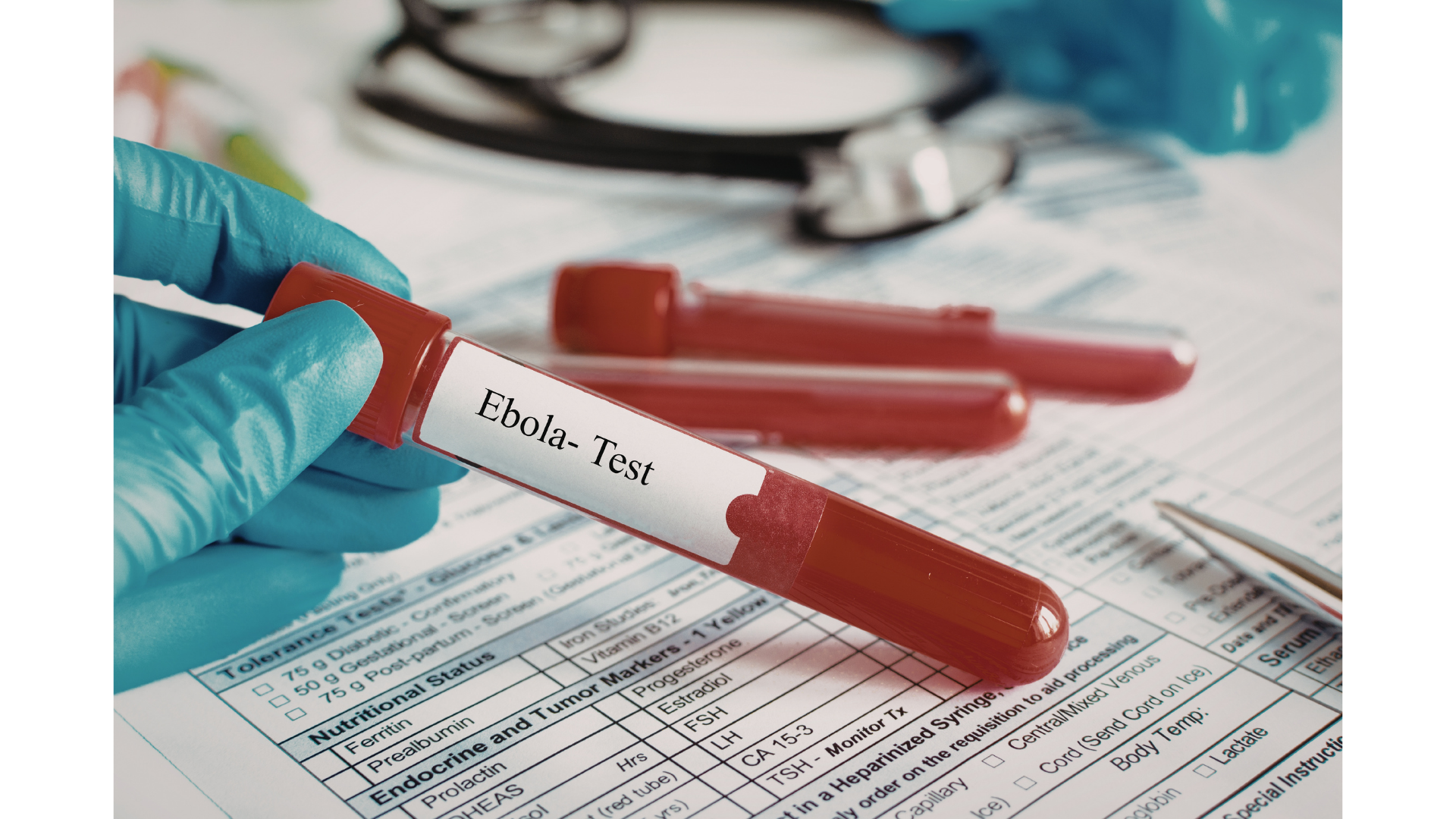 B&aacute;c sĩ ơi: Tỷ lệ tử vong l&ecirc;n đến 90%, Ebola nguy hiểm như thế n&agrave;o? - Ảnh 1.