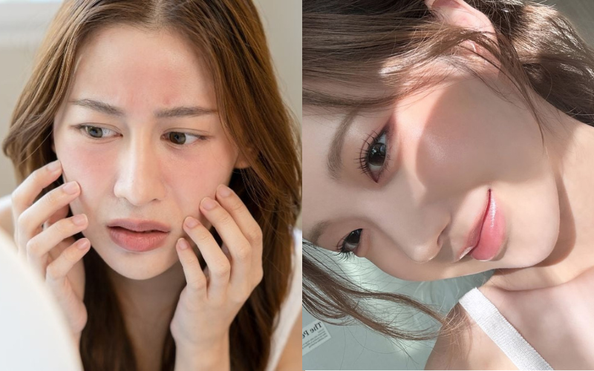 Collagen không phải cứ uống là đẹp mà bí quyết từ chuyên gia chia sẻ dưới đây! - Ảnh 1.