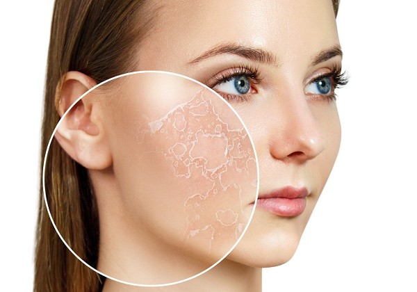Cảnh b&aacute;o: 5 dấu hiệu da thiếu collagen &lsquo;trầm trọng&rsquo; m&agrave; 99% chị em đều bỏ qua- Ảnh 3.
