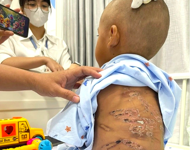 Đừng im lặng, hãy cứu mạng sống của trẻ em qua tổng đài 111 - Ảnh 1.