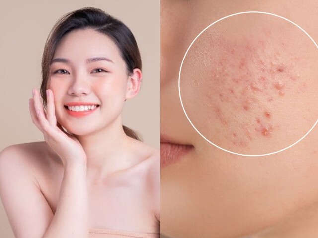 Hết tình trạng bí da mùa hè: Sản phẩm phục hồi này đang gây sốt khắp TikTok - Ảnh 1.