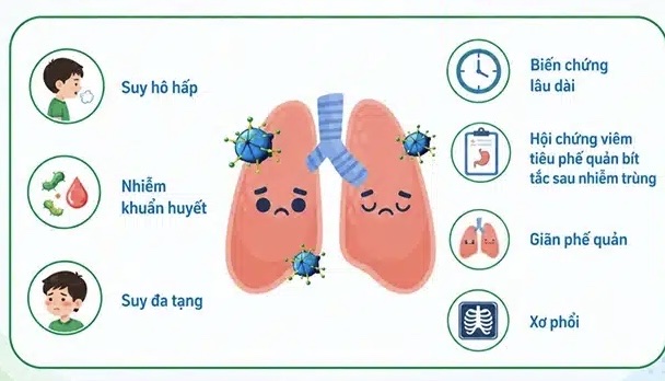 Adenovirus tăng 3 lần cùng kỳ 2025, ghi nhận nhóm trẻ học bơi bị nhiễm chéo - Ảnh 1.