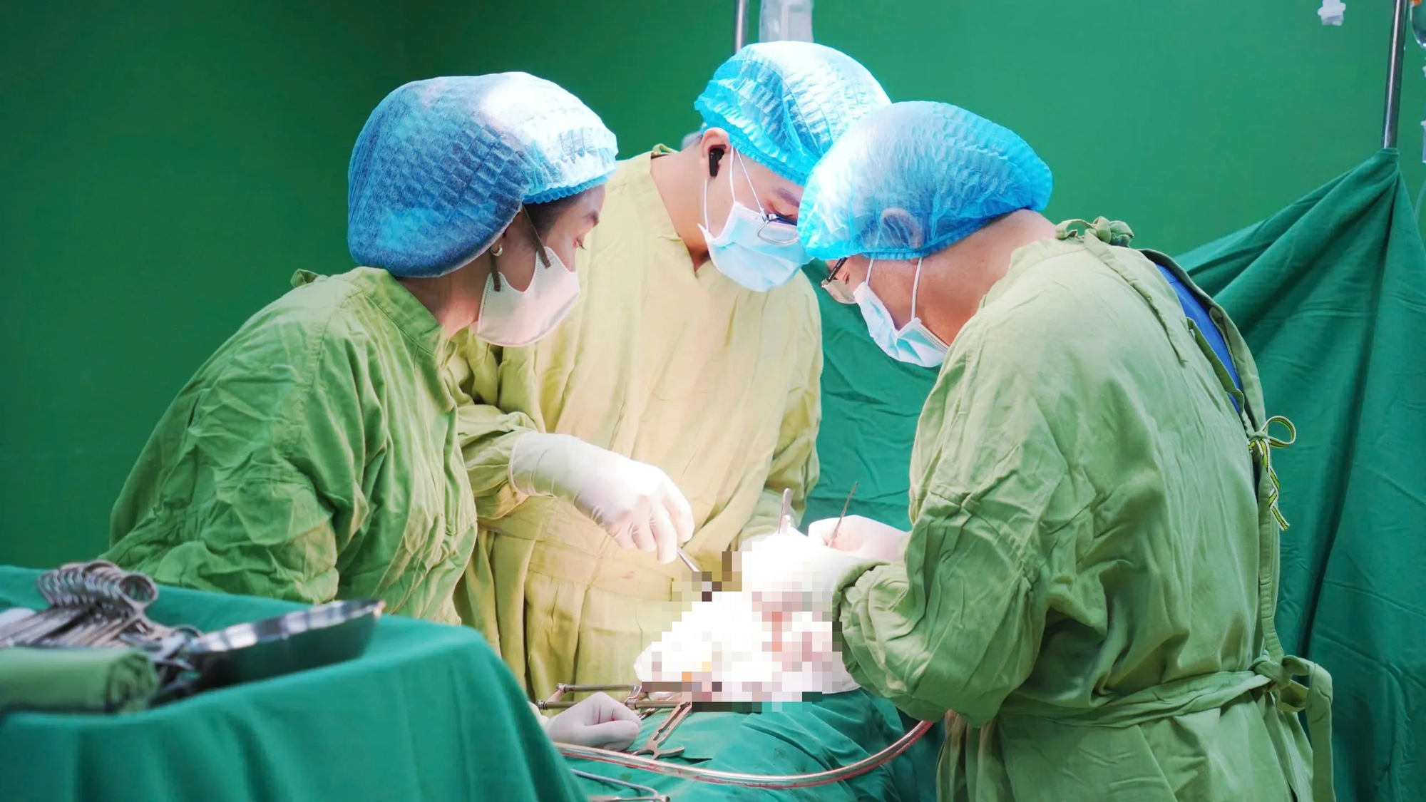 Phẫu thuật thành công sỏi ống tụy tại Gia Lai - Ảnh 2.