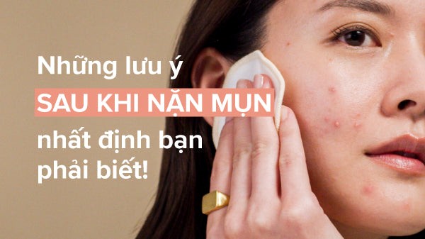Có nên nặn mụn? Chia sẻ từ chuyên gia khiến nhiều người tiếc vì không biết sớm- Ảnh 7.