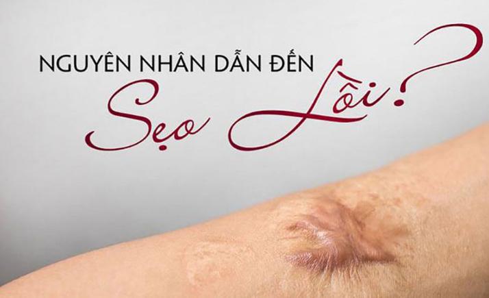 Sẹo lồi bao lâu thì hết? Chuyên gia da liễu trả lời khiến ai cũng bất ngờ - Ảnh 3.