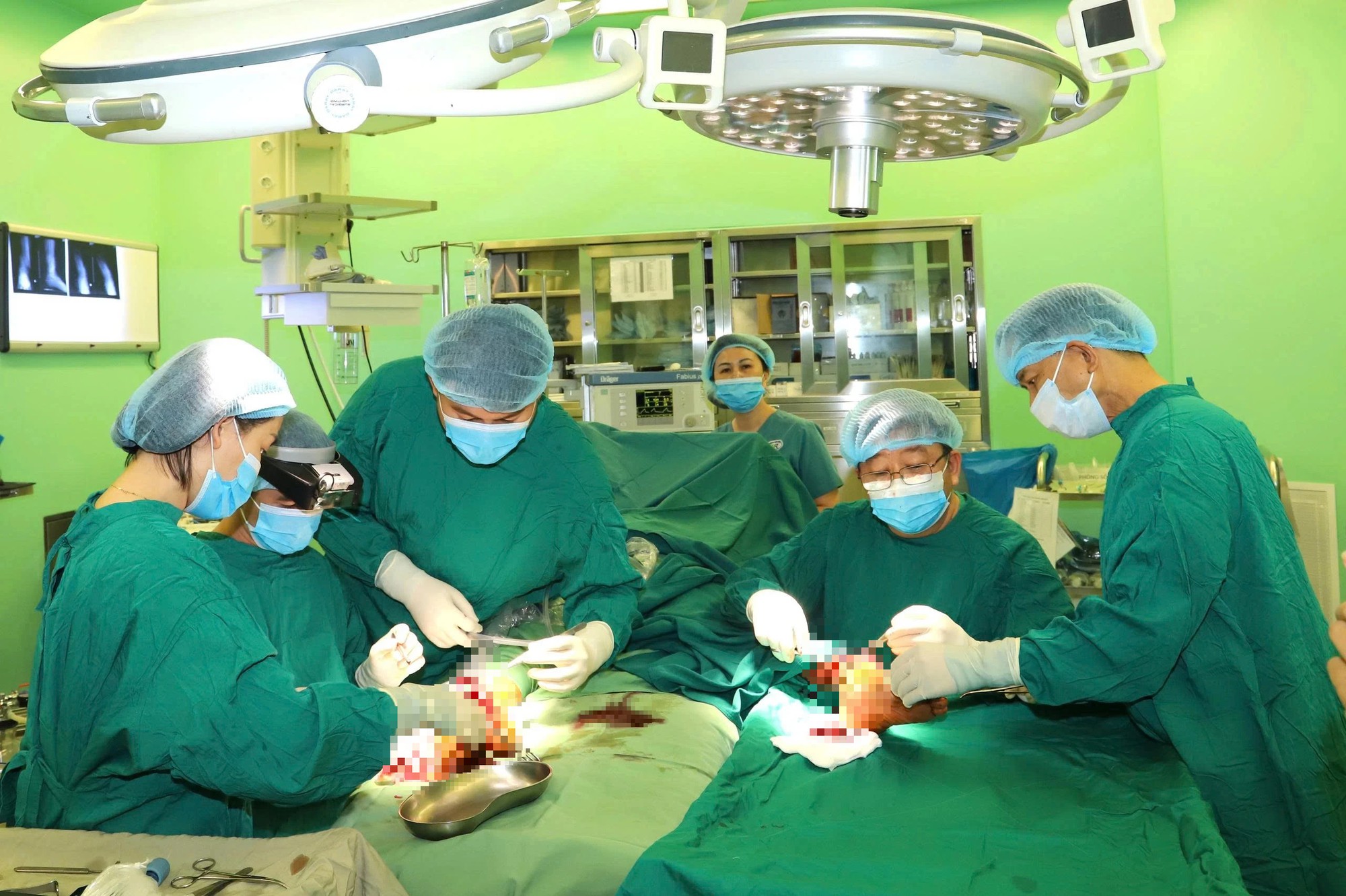 2 ê kíp phẫu thuật cùng lúc nối thành công 2 chân bị đứt gần lìa - Ảnh 1.