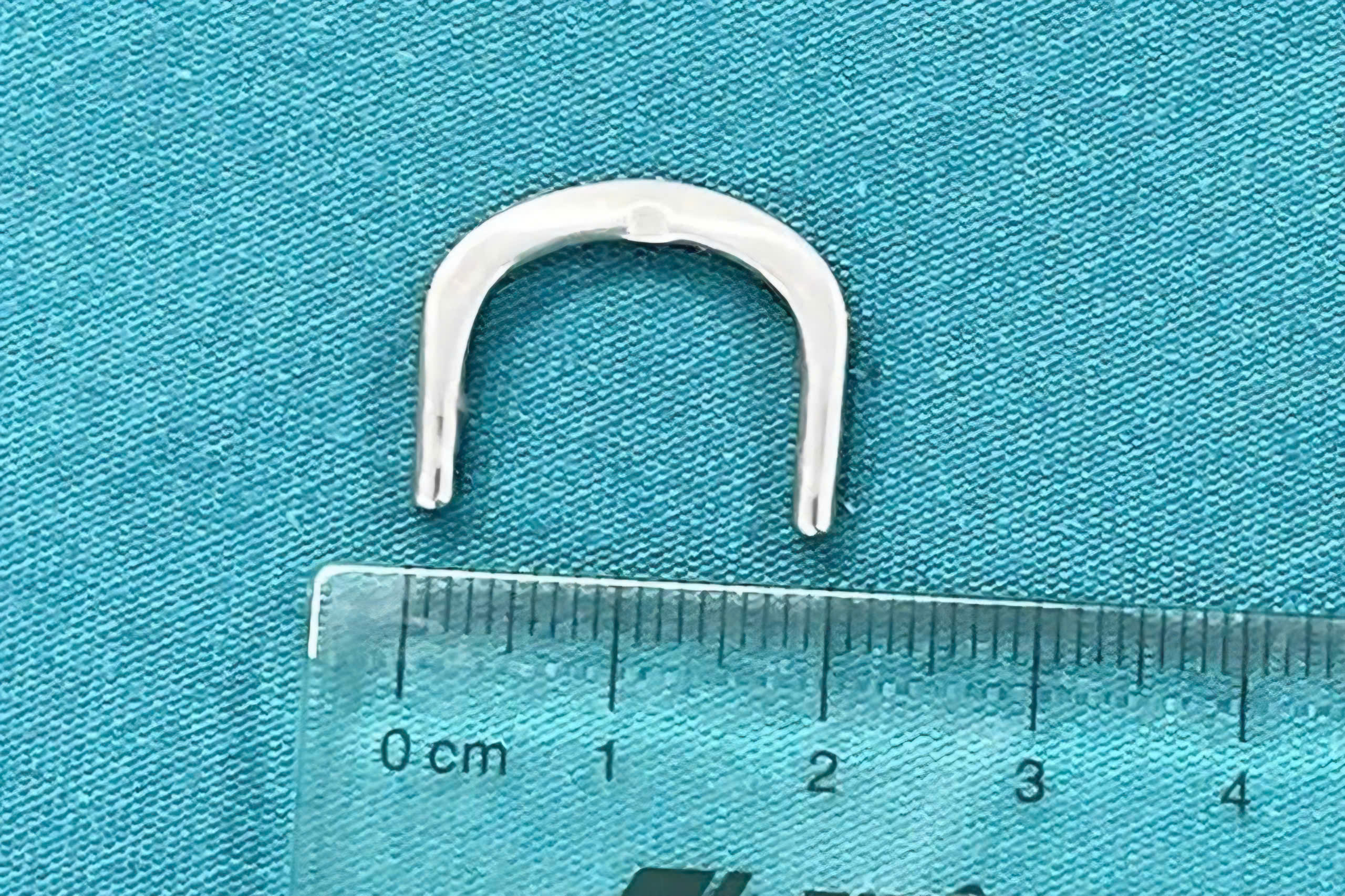 Bé gái 3 tuổi nuốt móc khóa đồng hồ mắc sâu trong tá tràng - Ảnh 1.