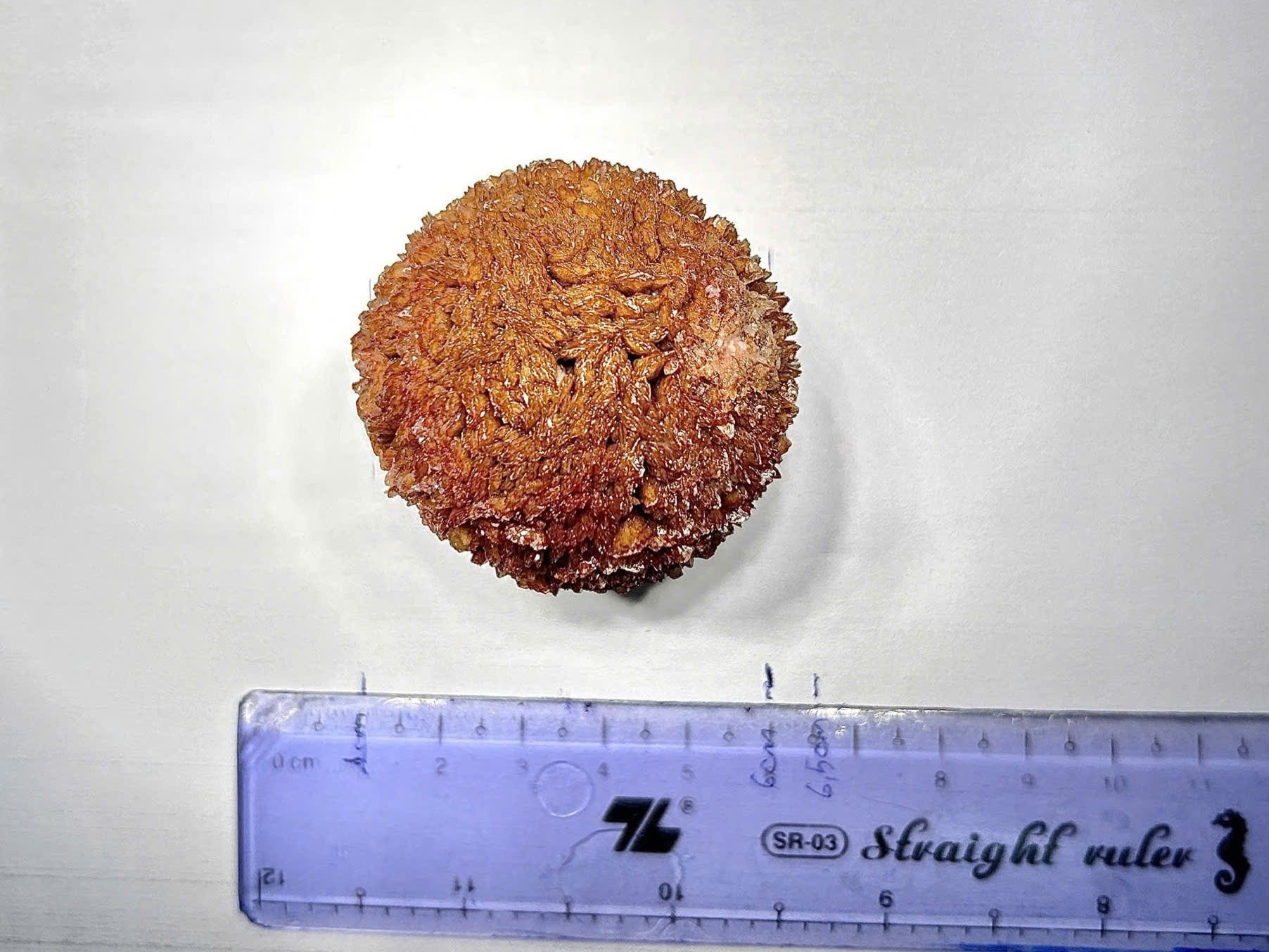 Người đàn ông mang viên sỏi nặng gần 100 g suốt 20 năm - Ảnh 3.