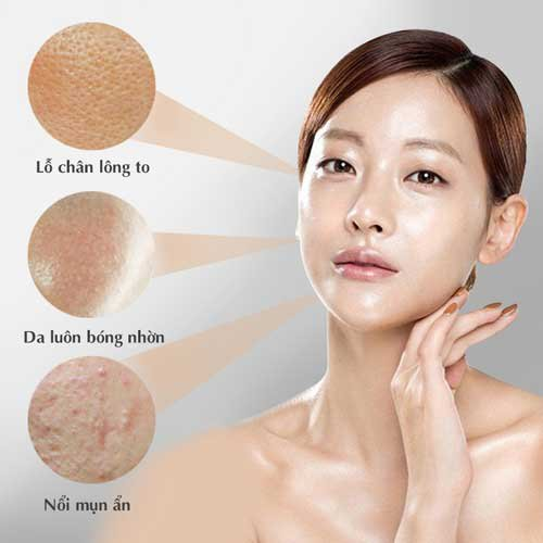 Vì sao mụn không dứt dù skincare đều đặn? Giải pháp cùng dược mỹ phẩm Việt Trioderma- Ảnh 3.