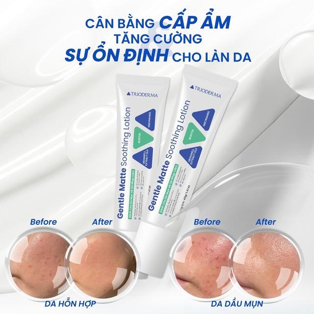 Ngỡ ngàng khi biết đây mới là bước quyết định làn da đẹp hay xấu - Ảnh 7.