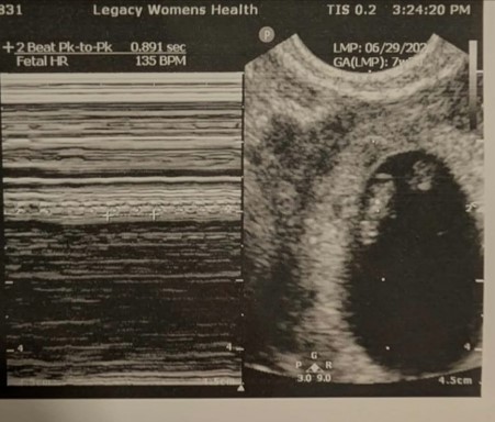 Cặp đôi người Mỹ đến Việt Nam làm IVF, thành công ngay lần chuyển phôi đầu - Ảnh 3.