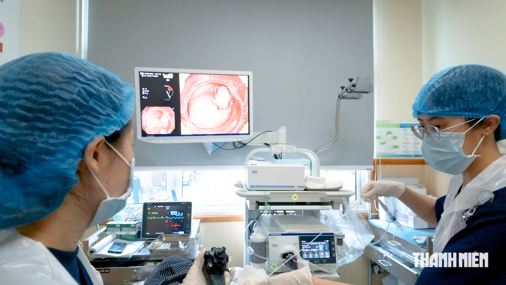 Hệ thống nội soi AI mới tại TP.HCM: Phát hiện ung thư tiêu hóa giai đoạn sớm - Ảnh 2.