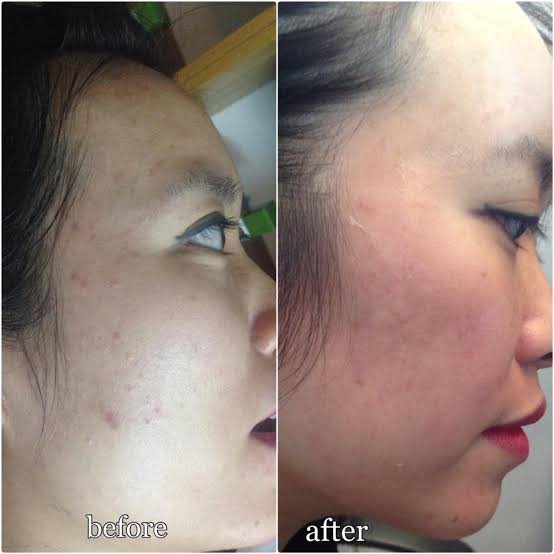 Niacinamide đang hot trở lại: Dùng thế nào để vừa giảm dầu vừa hỗ trợ sáng da? - Ảnh 5.