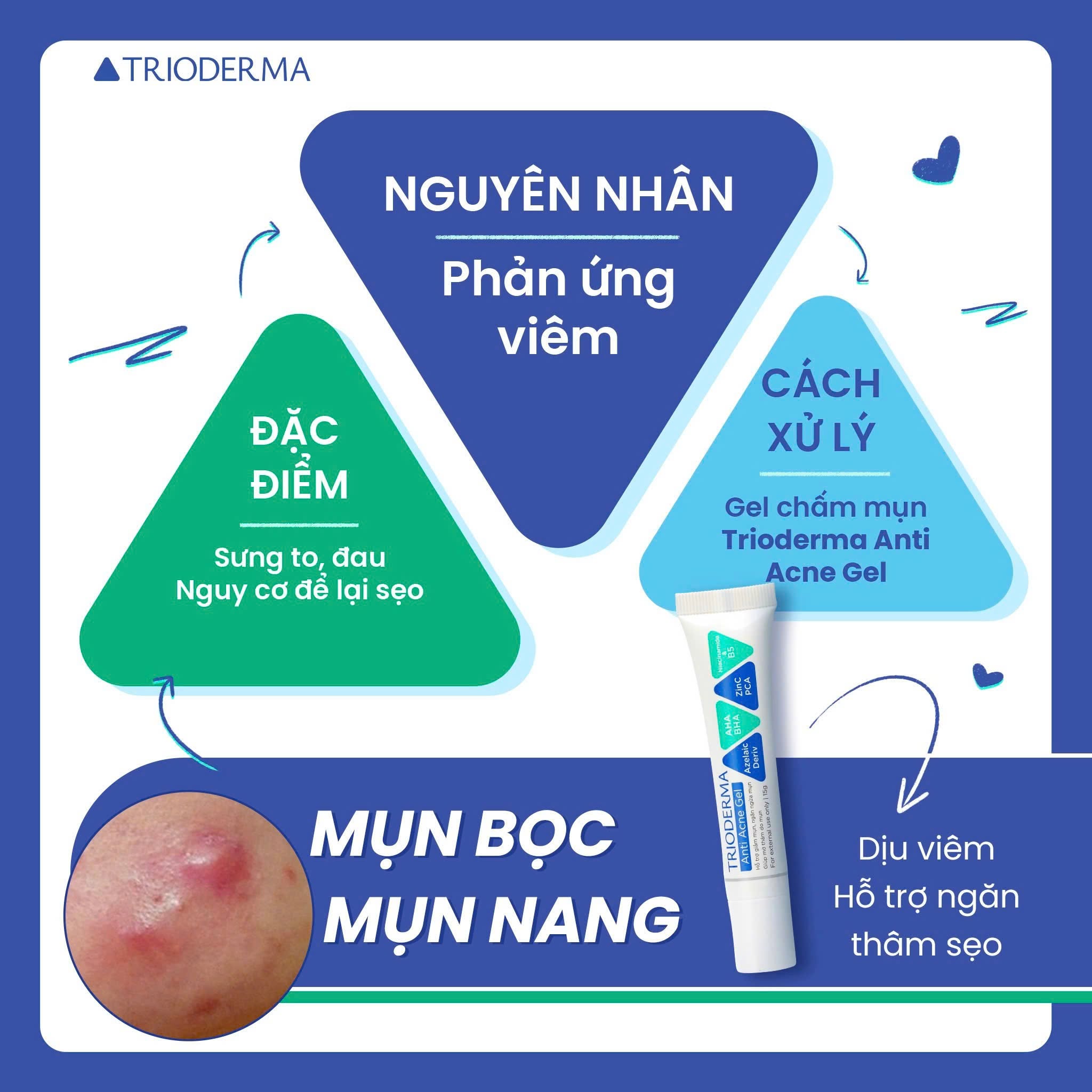 Bất ngờ kem giảm mụn tuổi dậy thì được phụ huynh tìm mua nhiều ‘made in VietNam’ - Ảnh 4.