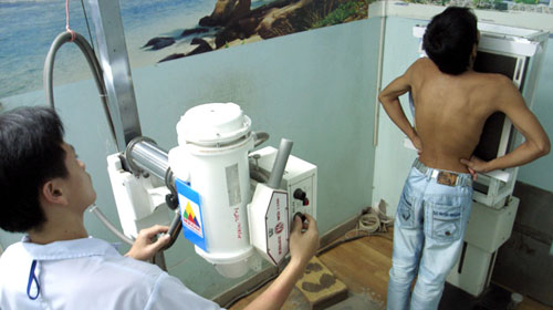 Chẩn đoán trật, chỉnh lại cũng khó - nd